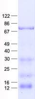 Human GNL3 / NS / Nucleostemin Protein (Recombinant His, N-Terminal)