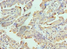 Polyclonal Rabbit anti-Human RICTOR Antibody (aa1-245, IHC)