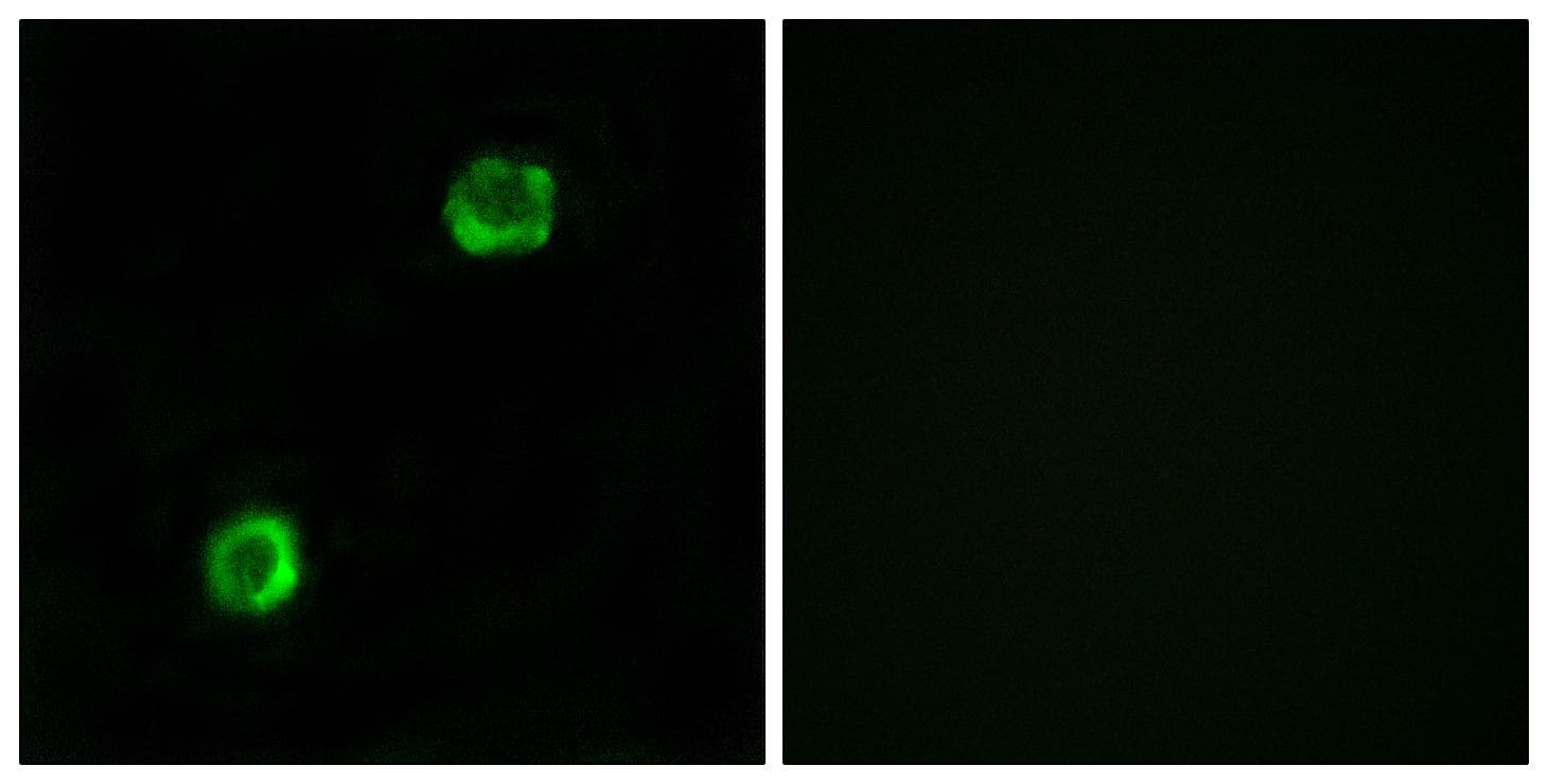 Polyclonal Rabbit anti-Human APOL2 / Apolipoprotein L 2 Antibody (IHC, IF, WB)