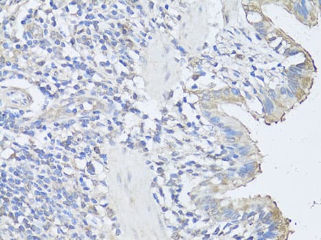 CASP3 / Caspase 3 Antibody
