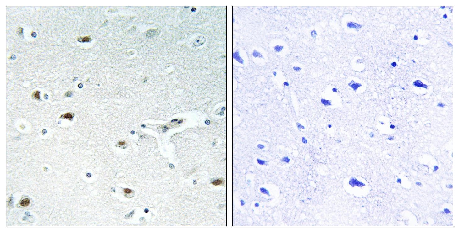 Polyclonal Rabbit anti-Human RB1 / Retinoblastoma / RB Antibody (Ab-826, IHC, IF)