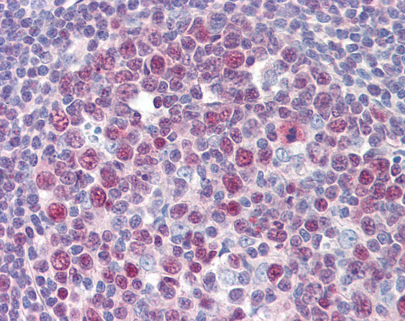 ARA55 / HIC-5 Antibody (N-Terminus)