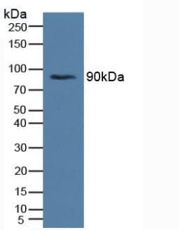 INSR / Insulin Receptor Antibody (aa622-945)