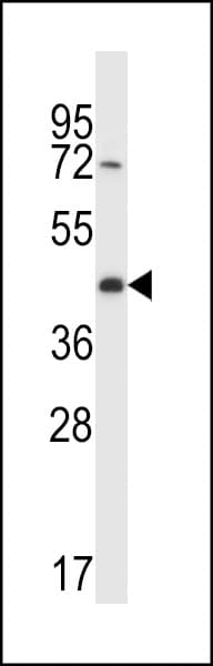 Polyclonal Rabbit anti-Human CREG2 Antibody (aa261-290, IHC, WB)
