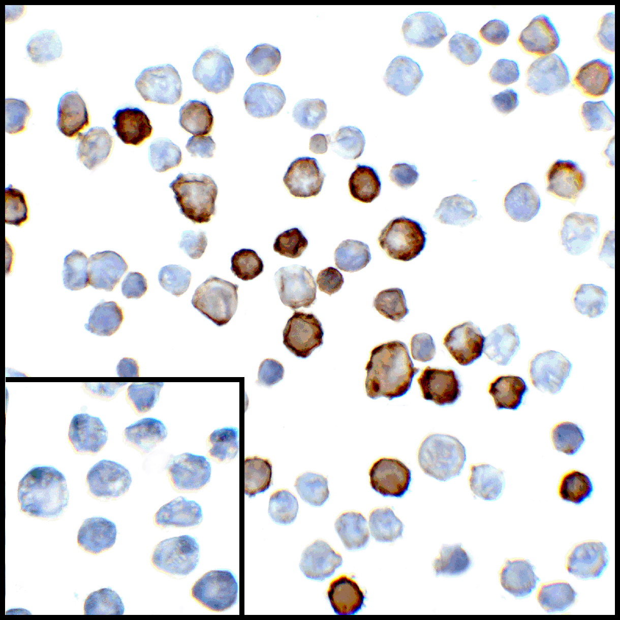 IHC-plus™ PD-L2 / PDCD1LG2 / CD273 Antibody (clone 4E10)