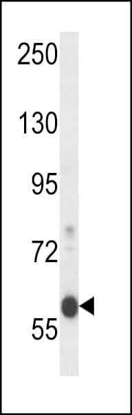 Polyclonal Rabbit anti-Human EFCAB7 Antibody (aa434-462, IHC, WB)
