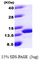 Human LAMTOR2 Protein (Recombinant His)