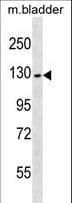 PRDM10 / TRIS Antibody (aa744-772)