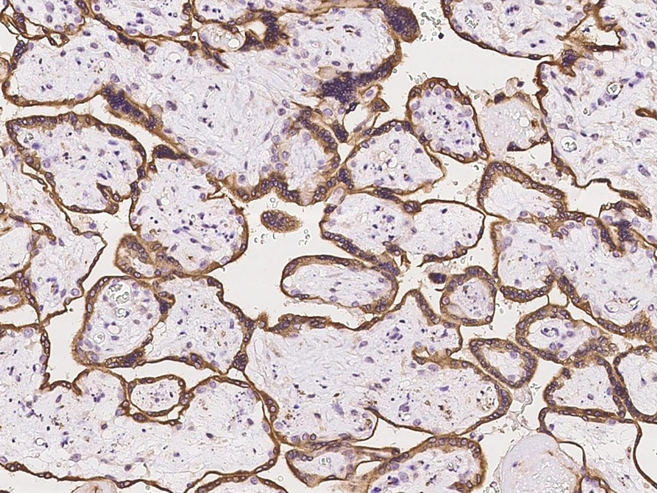 CYP19 / Aromatase Antibody