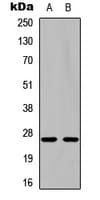 PathPlus™ NGF Antibody (Internal)