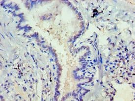 DVL2 / Dishevelled 2 Antibody (aa1-240)