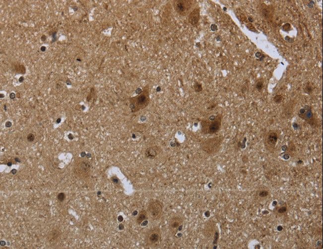 GYPC / Glycophorin C Antibody
