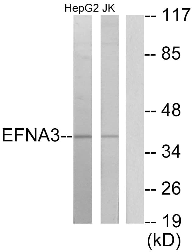 EFNA3 / Ephrin A3 Antibody (aa161-210)