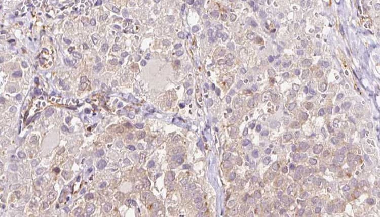 SEC63 Antibody