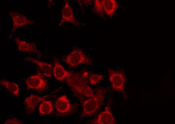 Polyclonal Rabbit anti-Human TDG / Thymine DNA Glycosylase Antibody (IF, WB)