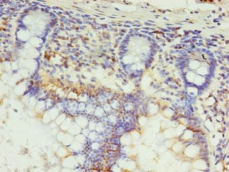SETX / Senataxin Antibody