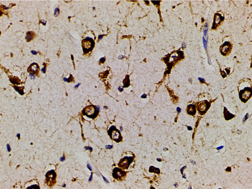 PIK3R1 / p85 Alpha Antibody (phospho-Tyr607)