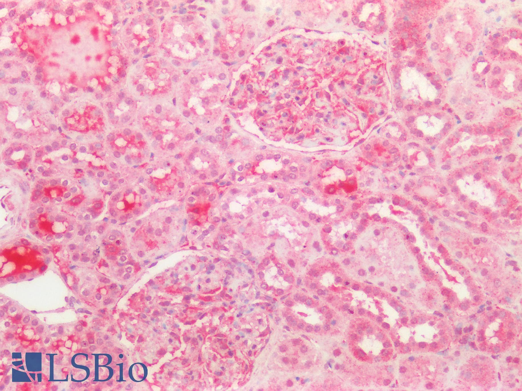 PathPlus™ Polyclonal Rabbit anti-Human BECN1 / Beclin-1 Antibody (N-Terminus, IHC, WB)