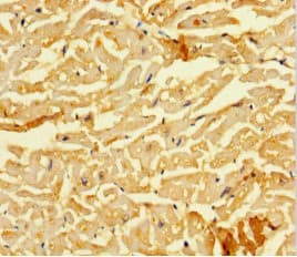 Polyclonal Rabbit anti-Human SMAD1 Antibody (IHC, IF)