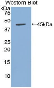 BAFF Receptor / CD268 Antibody (aa7-128, Cy3)
