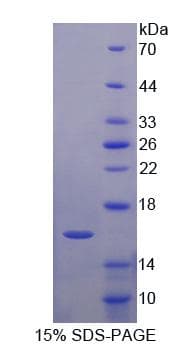 Mouse LIMCH1 Protein (Recombinant His-T7)