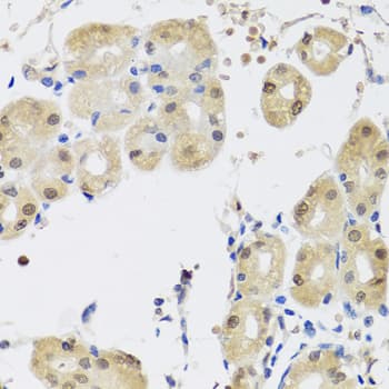 YAP / YAP1 Antibody (AP)