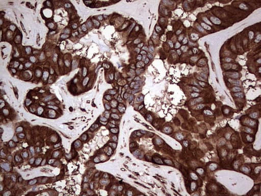 LRRTM1 Antibody (aa182-422, clone OTI5H9)