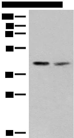 Polyclonal Rabbit anti-Human FAM84B Antibody (IHC, WB)