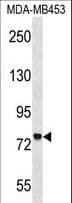 Polyclonal Rabbit anti-Human ZNF16 Antibody (aa53-81, WB)