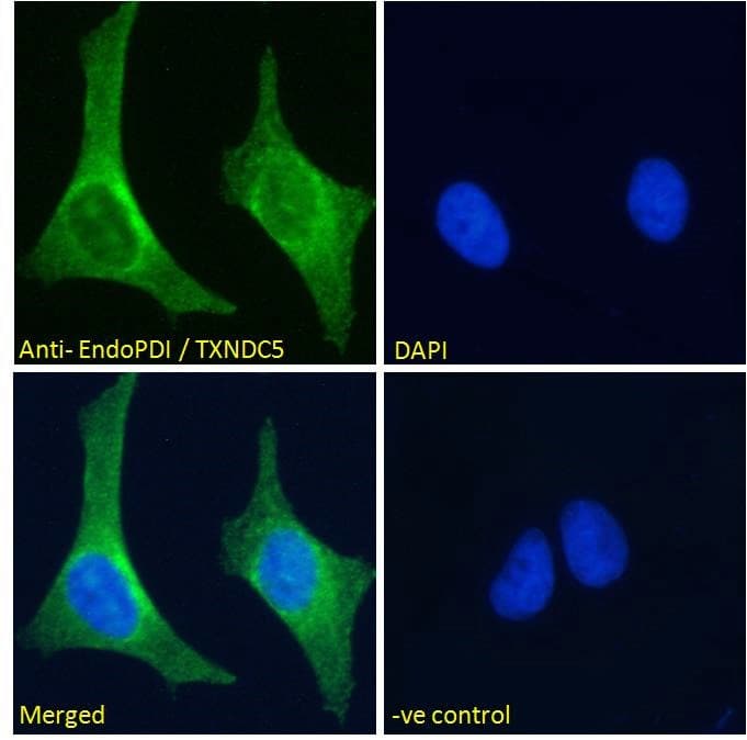 IHC-plus™ TXNDC5 / ERP46 Antibody (aa419-432)