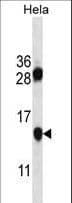 PHF5A / INI Antibody (aa81-110)