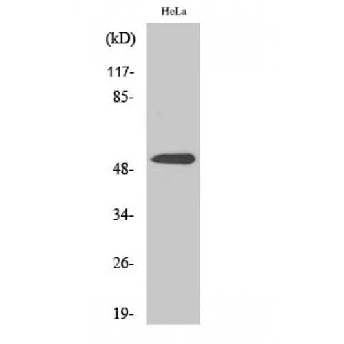 PARK2 / Parkin 2 Antibody (70-150 aa)