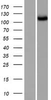 SGSM2 Protein (Over-Expression Lysate Myc-DDK (Flag))