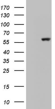 GBA / Glucosidase Beta Acid Antibody (aa40-315, clone OTI1D12)