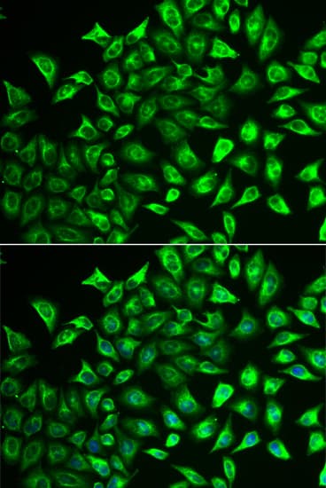 MMRN1 Antibody