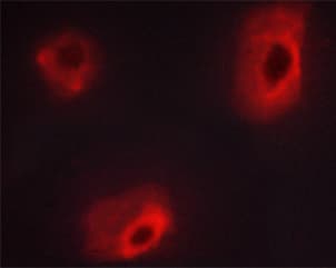 CALD1 / Caldesmon Antibody (phospho-Ser789)