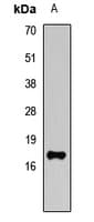 UBE2A Antibody