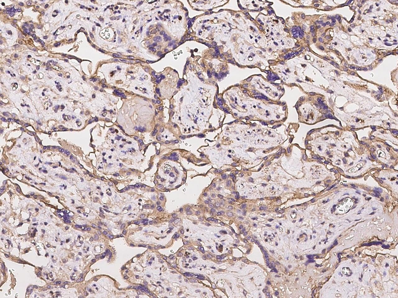 Polyclonal Rabbit anti-Human C11orf52 Antibody (IHC)