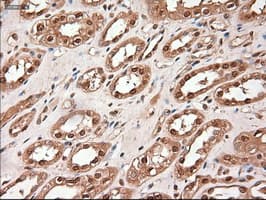 TRIM33 / TIF1-Gamma Antibody (clone OTI9D4)