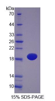 Pig E-FABP / FABP5 Protein (Recombinant His-S)