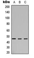 Polyclonal Rabbit anti-Human ARSB / Arylsulfatase B Antibody (C-Terminus, WB)