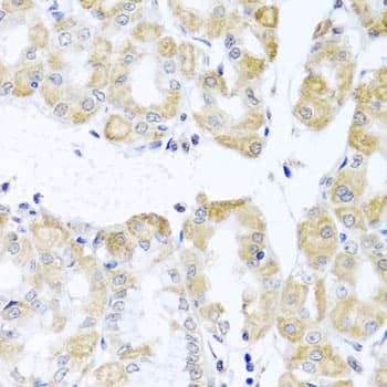Polyclonal Rabbit anti-Human DDX39 Antibody (IHC, WB)