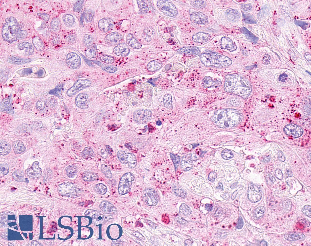 PathPlus™ OXER1 Antibody (C-Terminus)