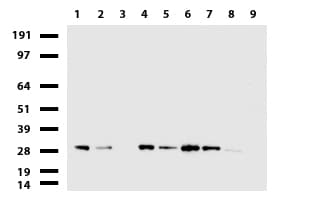 C14orf166 Antibody (clone UMAB175)