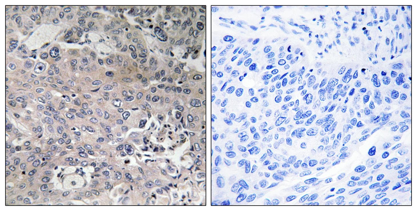 EFTU / TUFM Antibody