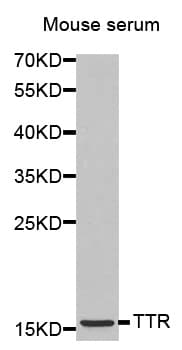 IHC-plus™ TTR / Transthyretin Antibody