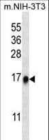RPL35 / Ribosomal Protein L35 Antibody (aa86-115)