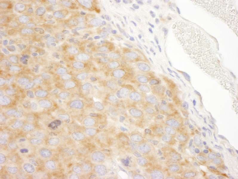 DDX3 / DDX3X Antibody (aa1-50)