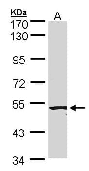 PathPlus™ Polyclonal Rabbit anti-Human ACVR2 / ACVR2A Antibody (IHC, WB)