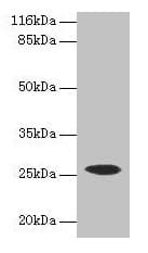 CSHL1 / CSH-Like 1 Antibody (aa1-128)